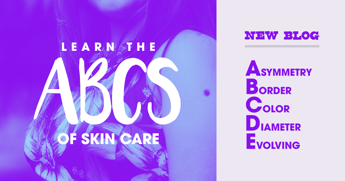 Summer Skin Care: ABC’s of Moles dermatology alamo heights san antonio texas