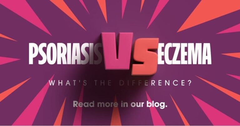 Psoriasis VS Eczema - What's the difference_