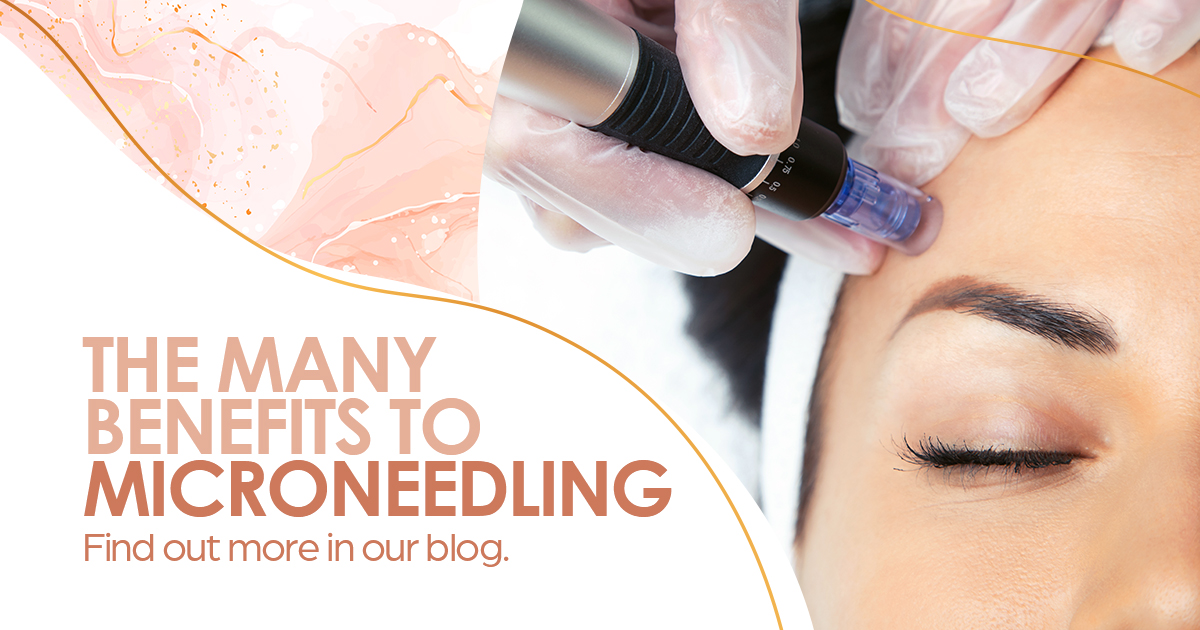 The many benefits to microneedling - find out more in our blog.