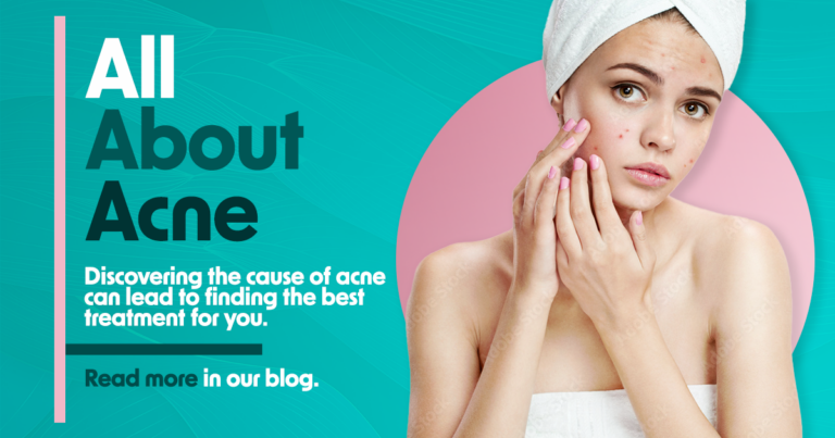 All about acne. Read more in our blog!