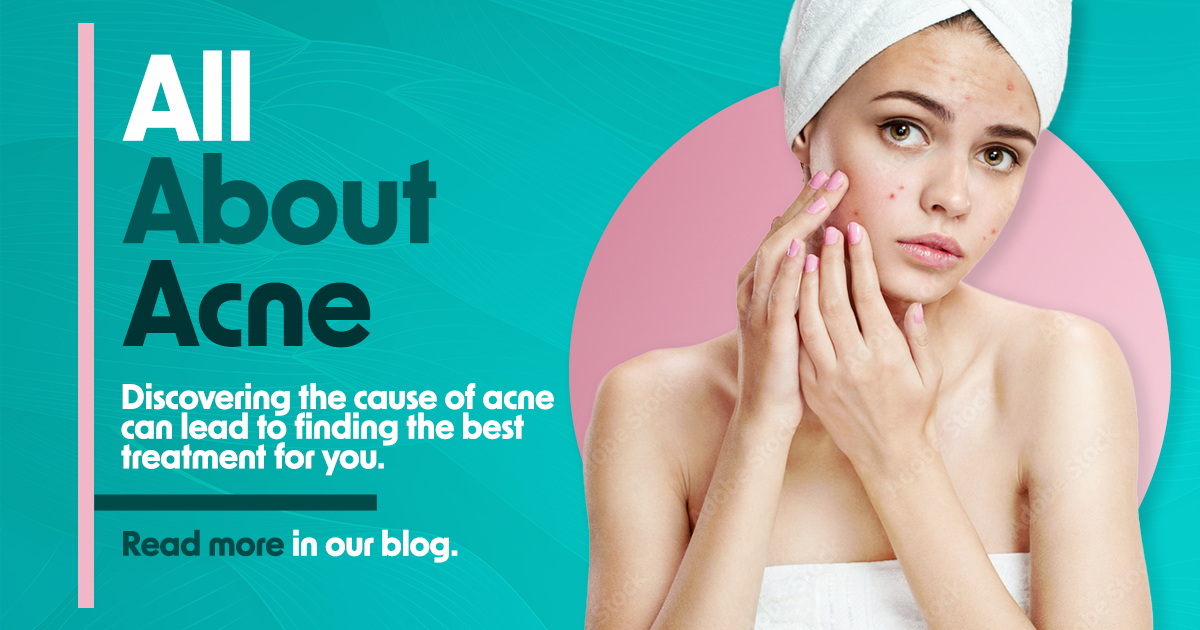 All about acne. Read more in our blog!