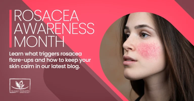Rosacea Awareness Month